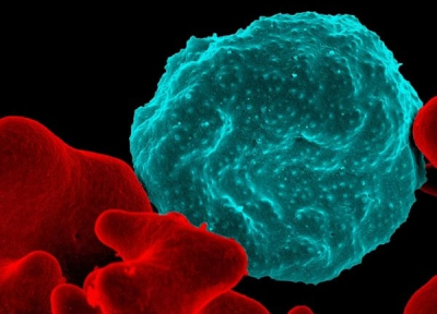 Colorized electron micrograph of red blood cell infected with malaria parasites (blue). The small bumps on the infected cell show how the parasite remodels its host cell. Uninfected cells (red) have smoother surfaces. Credit: NIAID/RML